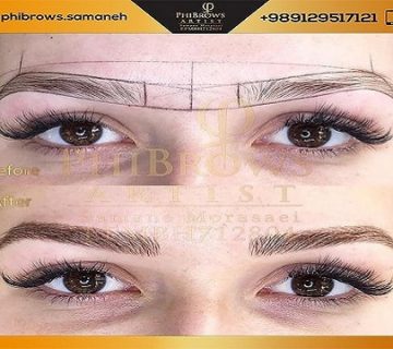 بهترین میکروبلیدینگ در الهیه