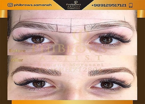 بهترین میکروبلیدینگ در الهیه