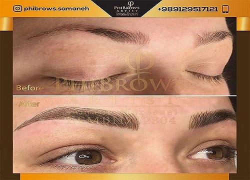 هزینه اجرای میکروبلیدینگ چقدر است؟