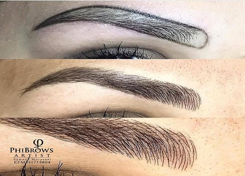 ترمیم ابرو چیست؟