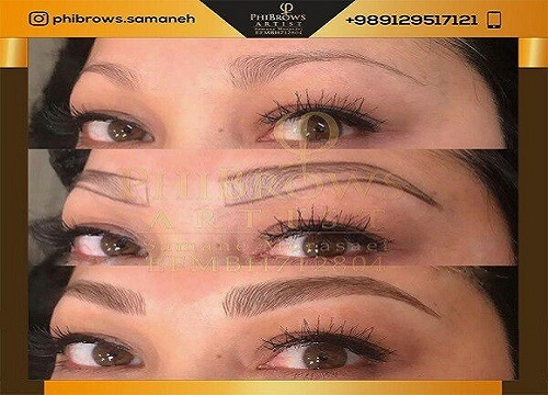 میکروبلیدینگ در پونک