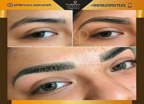 میکروبلیدینگ مانند هر روش زیبایی دارای معایب مختلفی است.