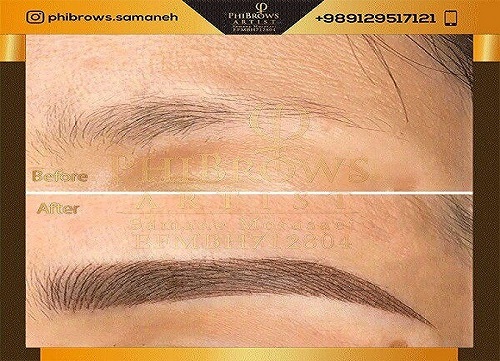 قبل از میکروبلیدینگ انجام چه مراقبت هایی لازم است؟