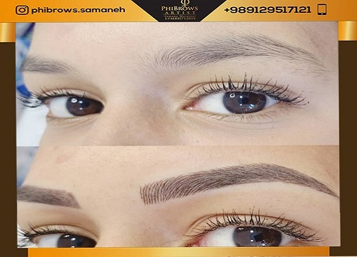 ویژگی بهترین مرکز میکروبلیدینگ در الهیه