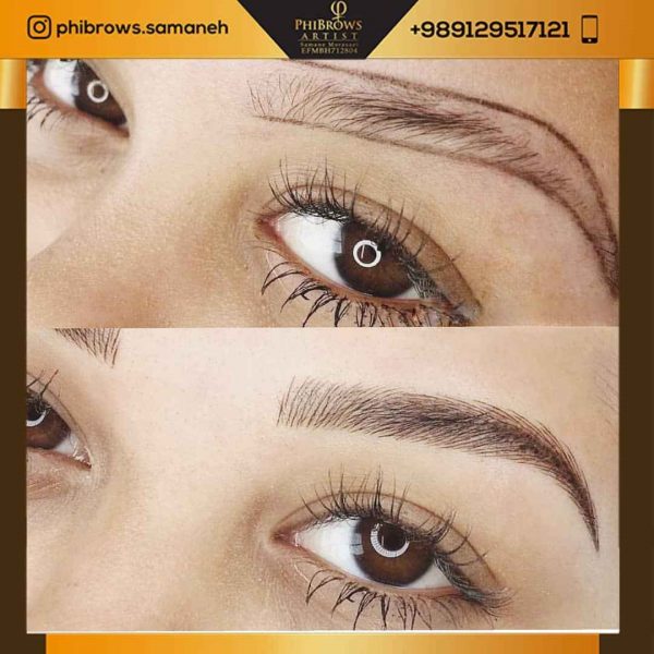 میکروپیگمنتیشن