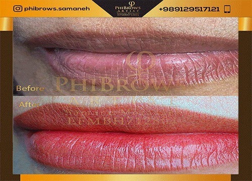 خدمات مرکز میکروبلیدینگ