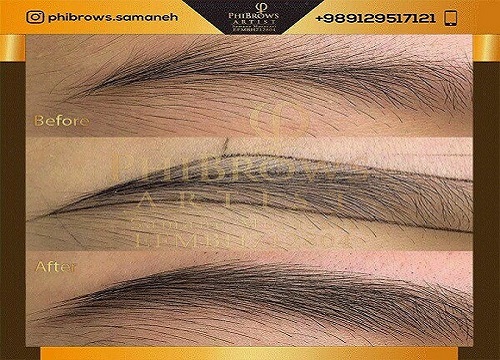 روش میکروبلیدینگ بهتر است یا کاشت ابرو