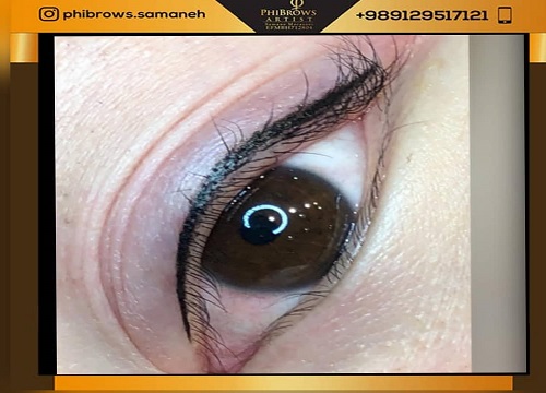 هزینه میکروبلیدینگ ابرو در تهران