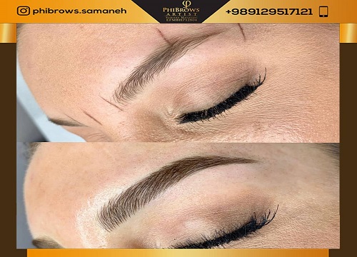 توصیه های بعد از اجرای میکروبلیدینگ