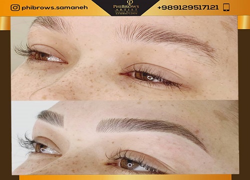 بهترین میکرو کار چشم در تهران