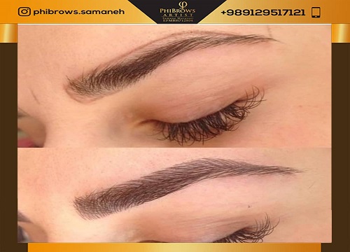 توصیه های بعد از اجرای میکروبلیدینگ