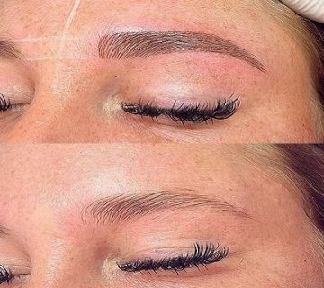 بهترین میکروبلیدینگ در مفتح