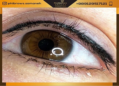 اگر چشمانت از حدقه بیرون زده های دارید و می خواهید که فرم چشم هایتان اصلاح شود :