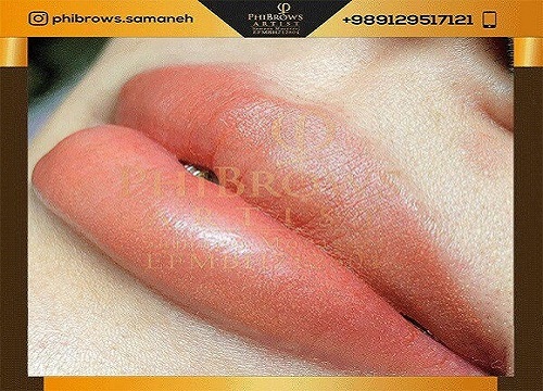 عوارض انجام میکروپیگمنتیشن لب