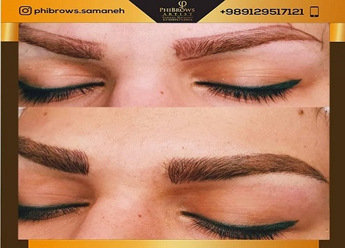  میکروبلیدینگ در تهرانپارس