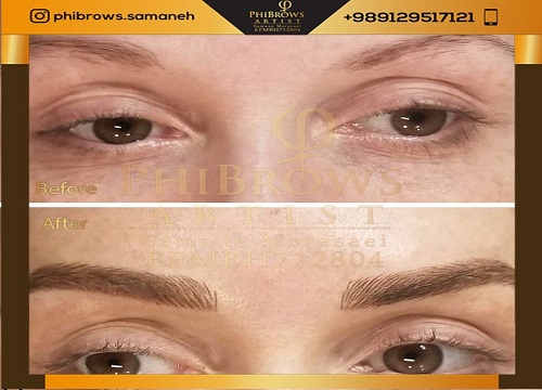 چرا مراجعه به بهترین مرکز میکروبلیدینگ اهمیت دارد؟