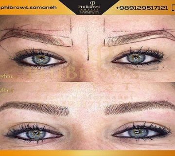 چگونه می توانیم یک متخصص حرفه ای برای اجرای میکروبلیدینگ انتخاب کنیم؟