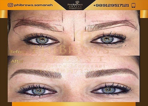 چگونه می توانیم یک متخصص حرفه ای برای اجرای میکروبلیدینگ انتخاب کنیم؟